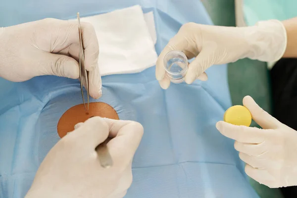 Biopsi: Apa, Kenapa, dan Bagaimana?