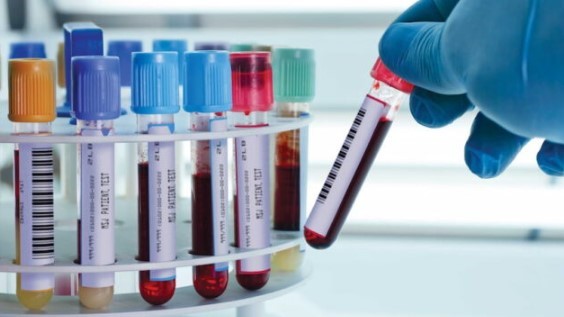 Pemeriksaan Biomarker pada Kanker